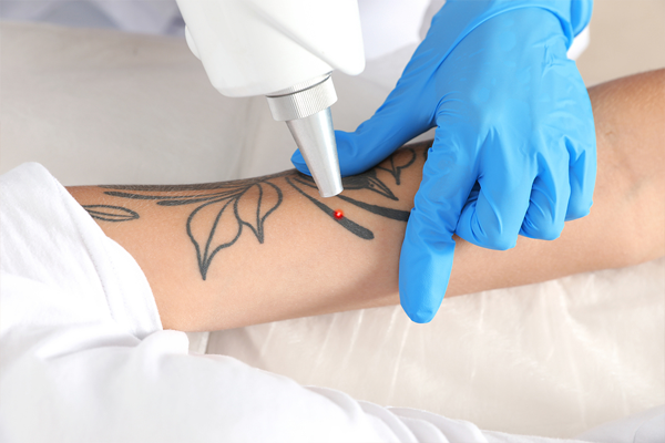 YAG laser cursus